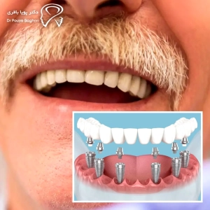 سن و سلامت عمومی بیمار