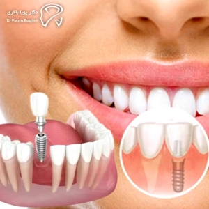 دغدغه بیماران: زمان و برنامه کاری