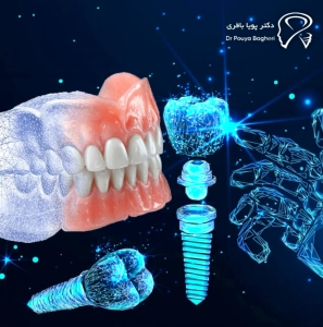 عملکرد جویدن، ثبات و ظاهر — چرا ایمپلنت تجربهای کاملاً متفاوت است؟