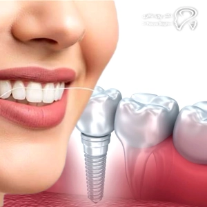 ویژگیهای برجسته کلینیک ایمپلنت ما