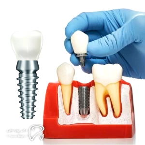 جمعبندی نهایی