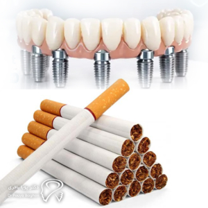 وقتی سیگار و لبخند در یک مسیر قرار می‌گیرند