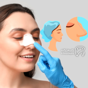 نتیجه‌ی عمل چقدر طبیعی خواهد بود؟