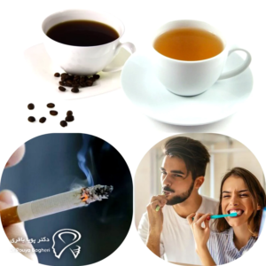 نکات عملی برای حفظ رنگ ایمپلنت