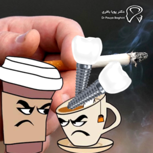 چرا قهوه، چای و سیگار روی ایمپلنت تاثیر می‌گذارند؟