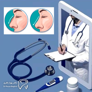 در مشاوره عمل بینی چه میگویند؟