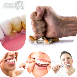 چطور از تغییر رنگ و التهاب اطراف ایمپلنت جلوگیری کنید؟