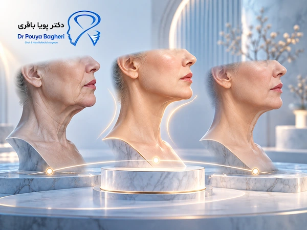 آیا افتادگی بعد از لیفت صورت دوباره برمی‌گردد؟