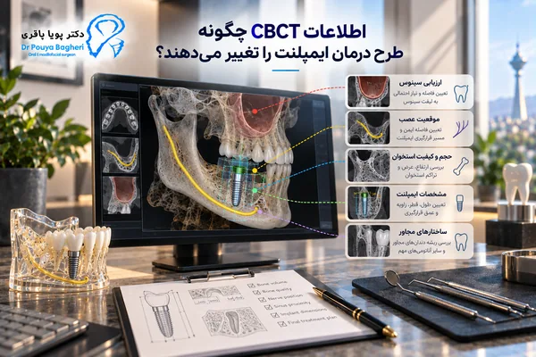 اطلاعات CBCT چگونه طرح درمان ایمپلنت را تغییر میدهند؟