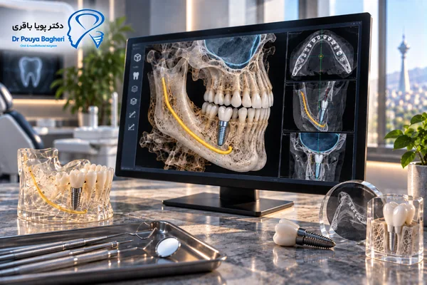 جمعبندی؛ CBCT چگونه به برنامهریزی دقیقتر ایمپلنت کمک میکند؟